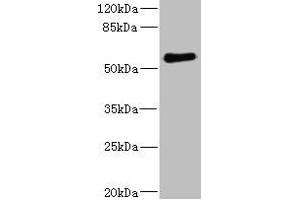 Western blot All lanes: FCRL2 antibody at 1. (FCRL2 抗体  (AA 20-100))