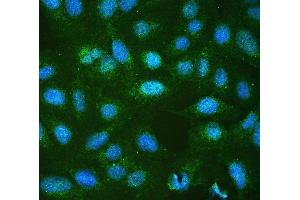 IF analysis of RP2 using anti-RP2 antibody (ABIN6719513).