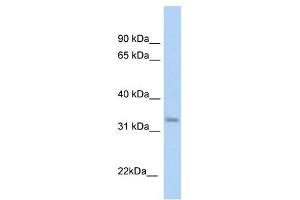 KHK antibody used at 1 ug/ml to detect target protein. (Ketohexokinase 抗体)