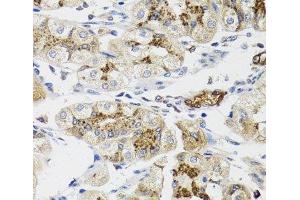 Immunohistochemistry of paraffin-embedded Human stomach using LFNG Polyclonal Antibody at dilution of 1:100 (40x lens). (LFNG 抗体)