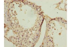 Immunohistochemistry (IHC) image for anti-Signal Peptidase Complex Subunit 2 Homolog (SPCS2) (AA 7-86) antibody (ABIN7169615)