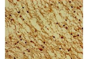 Immunohistochemistry of paraffin-embedded human brain tissue using ABIN7142640 at dilution of 1:100 (Serotonin Receptor 4 抗体  (AA 316-388))