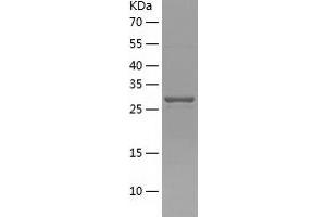 Western Blotting (WB) image for Acyl-CoA Binding Domain Containing 6 (ACBD6) (AA 1-282) protein (His tag) (ABIN7121676) (ACBD6 Protein (AA 1-282) (His tag))