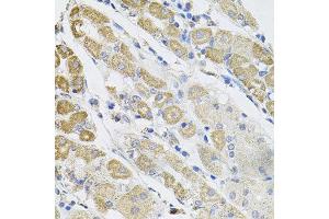 Immunohistochemistry of paraffin-embedded human stomach using SDC2 antibody at dilution of 1:100 (x40 lens). (Syndecan 2 抗体)