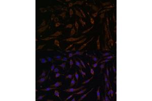 Immunofluorescence analysis of L929 cells using RPS6K antibody (5718) at dilution of 1:100.