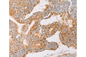 Immunohistochemistry (IHC) image for anti-Tyrosyl-tRNA Synthetase 2, Mitochondrial (YARS2) antibody (ABIN2422815) (YARS2 抗体)