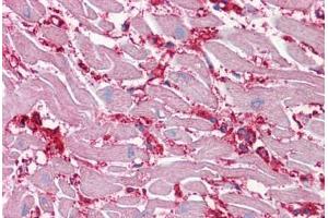 Human Heart: Formalin-Fixed, Paraffin-Embedded (FFPE) (ENO1 抗体  (AA 1-435))