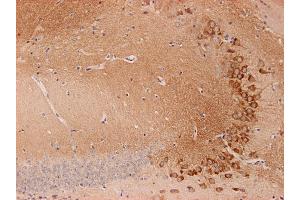 Indirect immunostaining of PFA fixed mouse brain section with anti-endophilin (dilution 1 : 200; red) and guinea pig anti-SV 2C (cat. (SH3G2 抗体  (AA 256-276))
