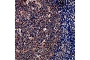 Immunohistochemical analysis of Tryptase delta staining in human tonsil formalin fixed paraffin embedded tissue section. (TPSD1 抗体)
