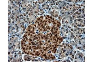 Immunohistochemistry (IHC) image for anti-Proteasome (Prosome, Macropain) 26S Subunit, ATPase, 3 (PSMC3) antibody (ABIN1501335)