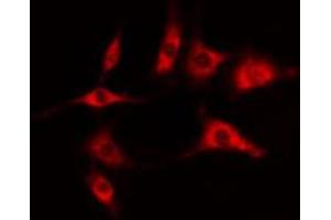 ABIN6274403 staining COLO205 cells by IF/ICC. (DOK6 抗体  (Internal Region))