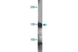 Western blot analysis of RC3H1 in HeLa cell lysate with RC3H1 polyclonal antibody  at 1 ug/mL. (RC3H1 抗体  (AA 1040-1090))
