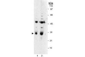 Western blot analysis of HPGD in LoVo whole cell lysates using HPGD polyclonal antibody . (HPGD 抗体)