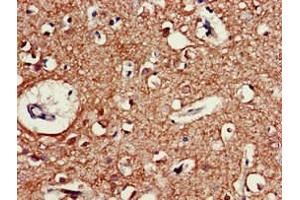 Immunohistochemistry of paraffin-embedded human brain tissue using ABIN7160353 at dilution of 1:100 (CHRM5 抗体  (AA 220-427))