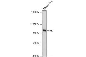 Western blot analysis of extracts of Mouse liver using HIC1 Polyclonal Antibody at dilution of 1:3000. (HIC1 抗体)