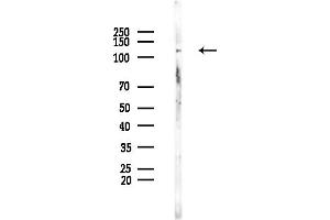 anti-RAN Binding Protein 6 (RANBP6) (Internal Region) antibody