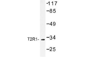Image no. 1 for anti-Taste Receptor, Type 2, Member 1 (TAS2R1) antibody (ABIN317775) (TAS2R1 抗体)