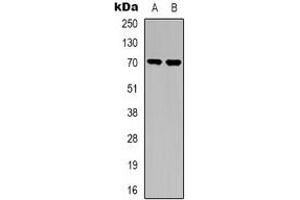 Western blot analysis of TGFBR2 expression in A549 (A), NIH3T3 (B) whole cell lysates. (TGFBR2 抗体)