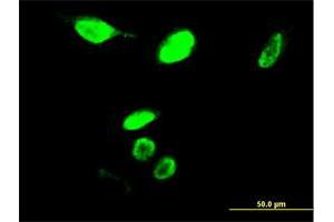 Immunofluorescence of monoclonal antibody to MYBL2 on HeLa cell. (MYBL2 抗体  (AA 601-700))