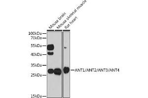 Western blot analysis of extracts of various cell lines, using /// antibody (ABIN7265627) at 1:1000 dilution. (ANT1+ANT2+ANT3+ANT4 (C-Term) 抗体)