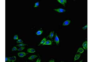 Immunofluorescent analysis of Hela cells using ABIN7146119 at dilution of 1:100 and Alexa Fluor 488-congugated AffiniPure Goat Anti-Rabbit IgG(H+L) (CXCL11 抗体  (AA 22-94))