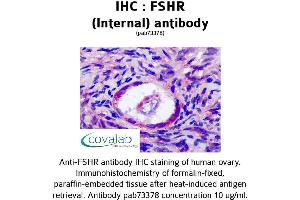 Image no. 1 for anti-Follicle Stimulating Hormone Receptor (FSHR) (Internal Region) antibody (ABIN1734475) (FSHR 抗体  (Internal Region))