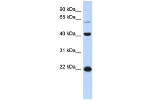 WB Suggested Anti-BLZF1 Antibody Titration: 0. (BLZF1 抗体  (N-Term))