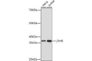 Western blot analysis of extracts of various cell lines, using LDHB Rabbit mAb (ABIN7268170) at 1:1000 dilution. (LDHB 抗体)