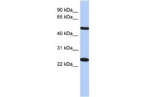 Western Blotting (WB) image for anti-Transmembrane Protein 161B (TMEM161B) antibody (ABIN2459638) (TMEM161B 抗体)
