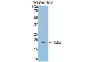 Western Blotting (WB) image for anti-Lecithin-Cholesterol Acyltransferase (LCAT) (AA 290-432) antibody (ABIN1859624) (LCAT 抗体  (AA 290-432))