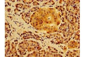 Immunohistochemistry of paraffin-embedded human pancreatic tissue using ABIN7155006 at dilution of 1:100 (HS2ST1 抗体  (AA 29-229))
