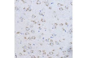 Immunohistochemistry of paraffin-embedded mouse brain using FAK Rabbit pAb (ABIN6131638, ABIN6146424, ABIN6146426 and ABIN6215254) at dilution of 1:100 (40x lens). (FAK 抗体  (AA 425-660))