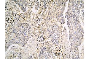 IHC analysis of PPA1 using anti-PPA1 antibody (ABIN6719527). (Pyrophosphatase (Inorganic) 1 (PPA1) (AA 7-236) 抗体)