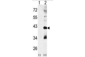 Western blot analysis of CTDSP1 (arrow) using rabbit polyclonal p38 beta Antibody (MAPK11 抗体  (Middle Region))
