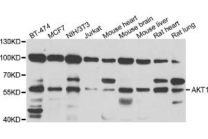 Western blot analysis of extracts of various cell lines, using AKT1 antibody. (AKT1 抗体)