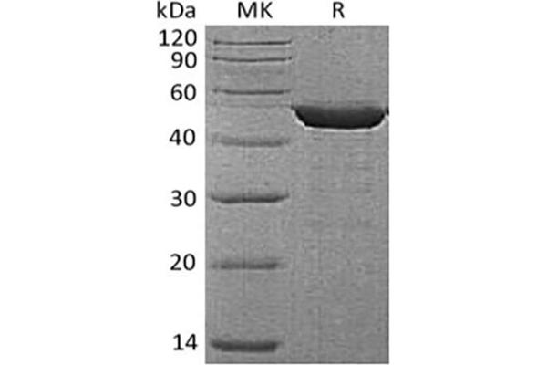ENO1 Protein (His tag)