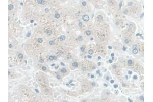 Detection of PDE1A in Human Liver Tissue using Polyclonal Antibody to Phosphodiesterase 1A, Calmodulin Dependent (PDE1A) (PDE1A 抗体  (AA 2-318))