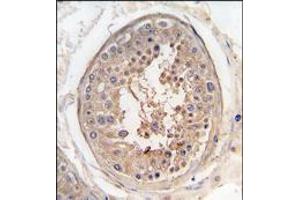 Formalin-fixed and paraffin-embedded human testis tissue reacted with SPAG9 antibody (Center), which was peroxidase-conjugated to the secondary antibody, followed by DAB staining (SPAG9 抗体  (Middle Region))