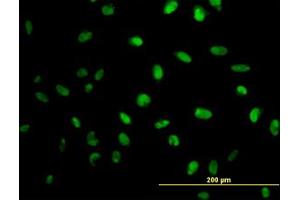 Image no. 3 for anti-N-Methylpurine-DNA Glycosylase (MPG) (AA 1-90) antibody (ABIN598820) (MPG 抗体  (AA 1-90))