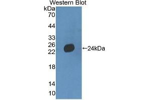 Detection of Recombinant LAMb3, Mouse using Polyclonal Antibody to Laminin Beta 3 (LAMb3) (Laminin beta 3 抗体  (AA 595-778))