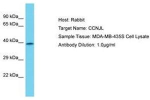 Image no. 1 for anti-Cyclin J-Like (CCNJL) (AA 337-386) antibody (ABIN6750669) (CCNJL 抗体  (AA 337-386))
