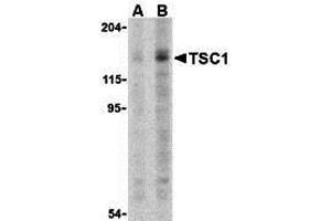 Western Blotting (WB) image for anti-Tuberous Sclerosis 1 (TSC1) (C-Term) antibody (ABIN1030780) (TSC1 抗体  (C-Term))