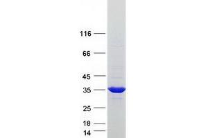 Western Blotting (WB) image for Sulfotransferase Family, Cytosolic, 1A, Phenol-Preferring, Member 4 (SULT1A4) (Transcript Variant 3) protein (Myc-DYKDDDDK Tag) (ABIN2732933)