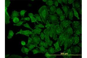 Immunofluorescence of monoclonal antibody to STX4A on HeLa cell. (Syntaxin 4 抗体  (AA 19-119))