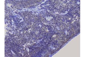 IHC analysis of NRF1 using anti-NRF1 antibody (ABIN6719347).