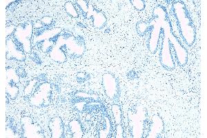 ABIN190842 Negative Control showing staining of paraffin embedded Human Prostate, with no primary antibody.