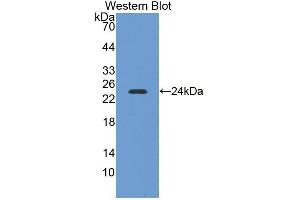 Detection of Recombinant NEIL3, Mouse using Polyclonal Antibody to Nei Endonuclease VIII Like Protein 3 (NEIL3) (NEIL3 抗体  (AA 2-187))