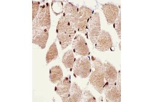 Immunohistochemical analysis of paraffin-embedded H. (SSNA1 抗体  (N-Term))