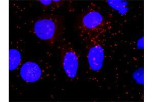 Proximity Ligation Analysis of protein-protein interactions between AKT1 and SMAD4. (SMAD4 抗体  (AA 56-165))