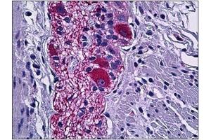 Immunohistochemistry (Paraffin-embedded Sections) (IHC (p)) image for anti-Dihydropyrimidinase-Like 2 (DPYSL2) (C-Term) antibody (ABIN784201)